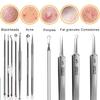 Ingrown Hair Tweezers Acne Blackhead Removal Needles Black Dots Cleaner Pore Cleaner Deep Cleansing Face Skin Care Tools