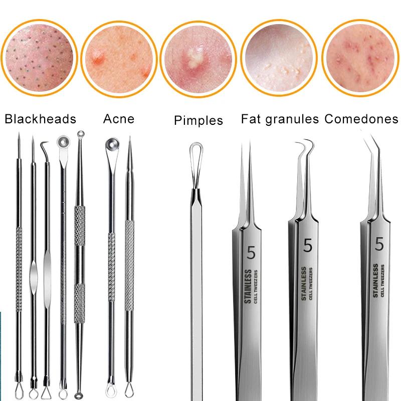 Ingrown Hair Tweezers Acne Blackhead Removal Needles Black Dots Cleaner Pore Cleaner Deep Cleansing Face Skin Care Tools