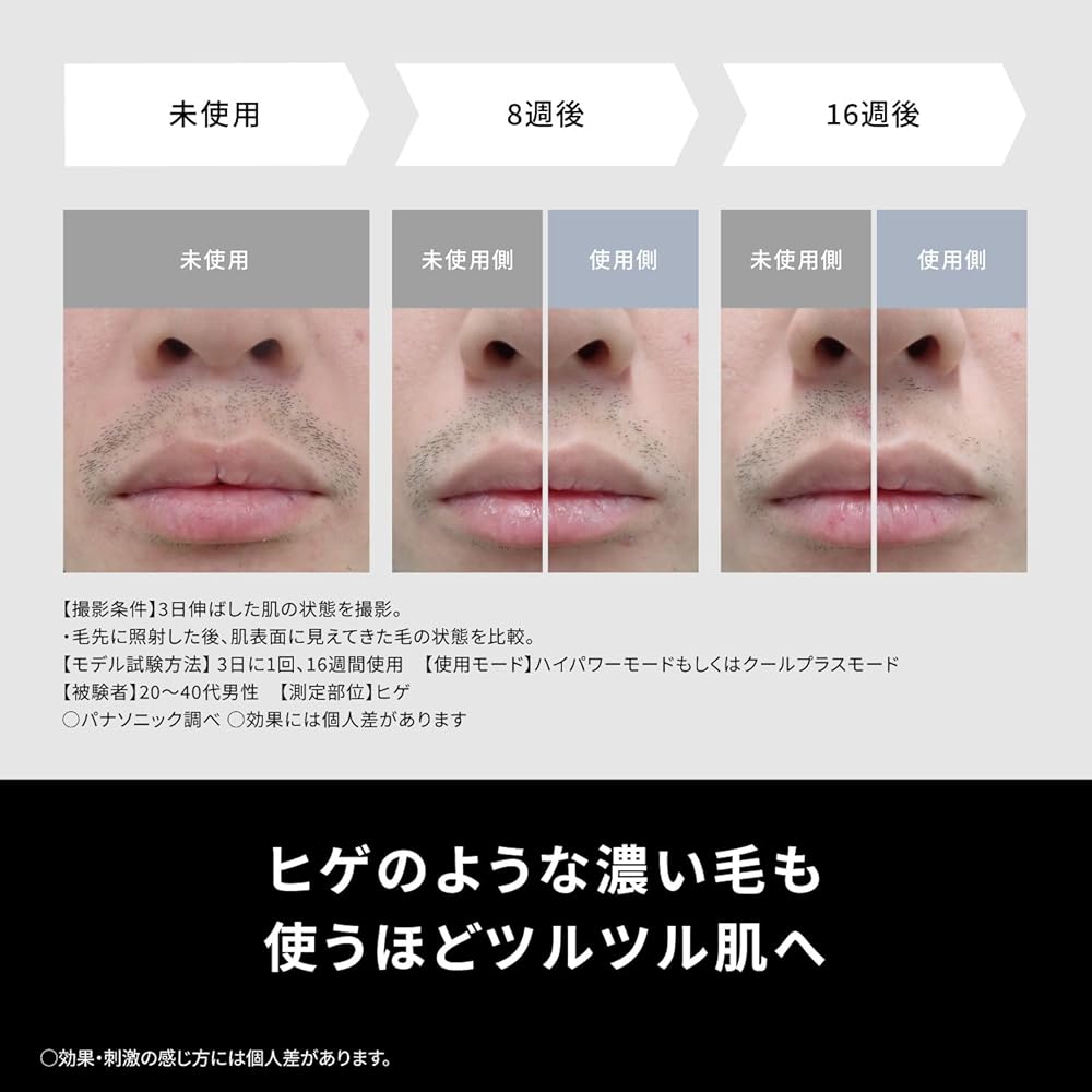 Panasonic Smooth Epi Power & Cool Hair Removal Device with Cooling Function (ES-WG0B-H, Gray)