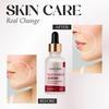 Raza Rida Care Niacinamide Serum, Reduces Blemishes & Acne Marks, 30ml (1.01 Fl Oz)