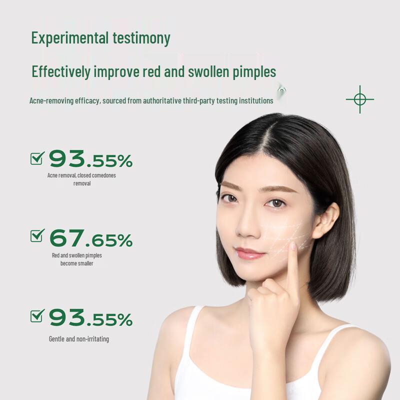 

URIS Acne Treatment Cream