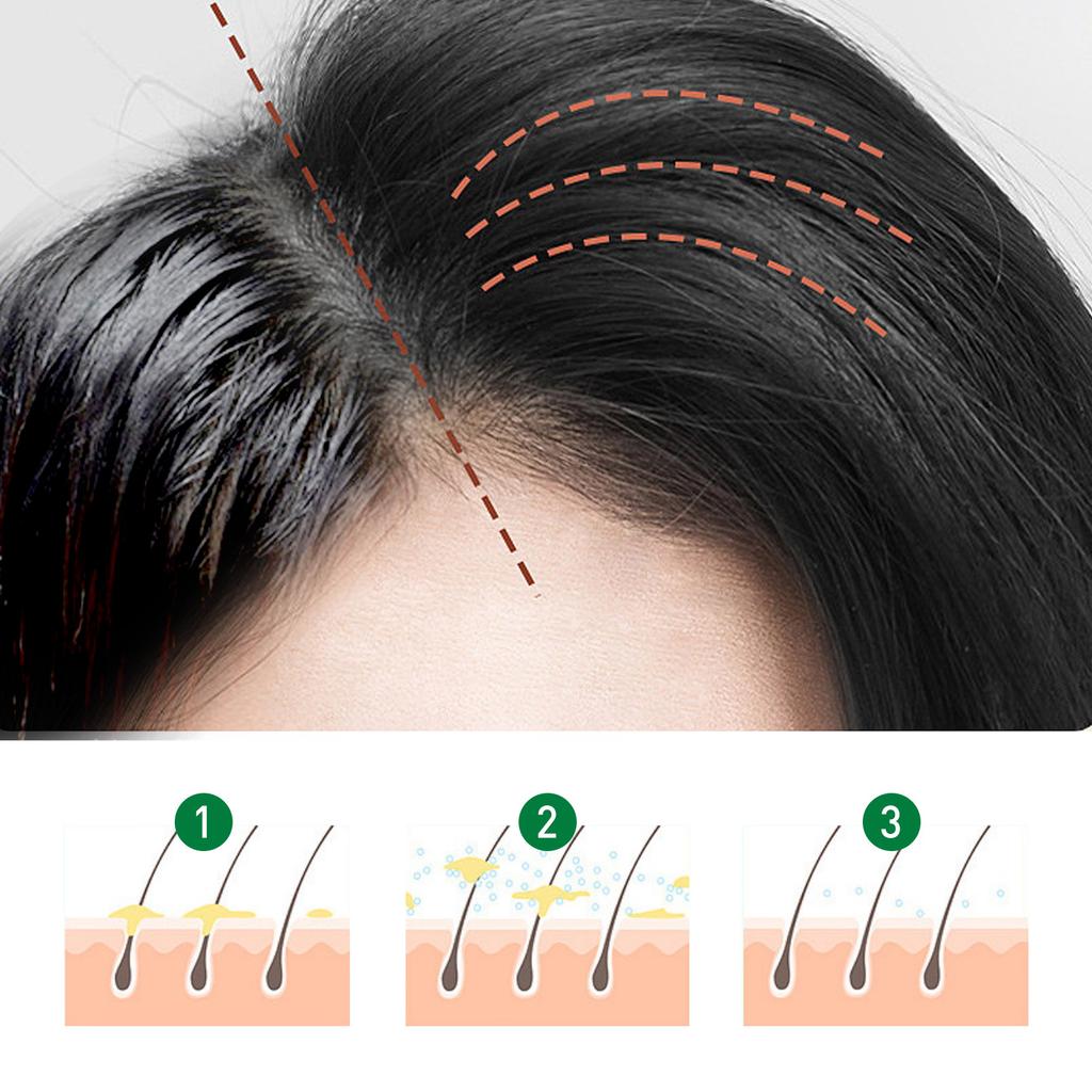 Jaysuing 150 ml Oil Control Bez umývania vlasov Fluffy Spray Bezoplachový suchý šampón Remove Attached Sweat Static Oil-control Hair Powder Hairspray