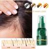 Ginger Hair Essence 30ml Promotes Hair Growth, Prevents Dry, Damaged, and Thinning Hair, and Acts As an Anti-hair Loss and Hair Growth Spray
