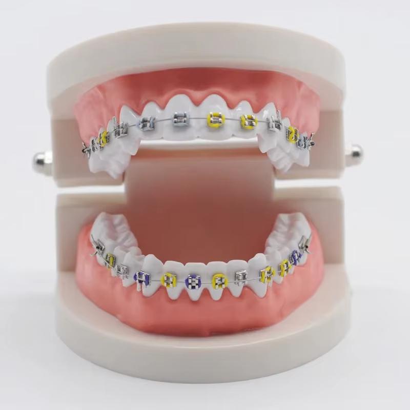 1040 Uds/40 Varillas De Ligadura Elástica De Ortodoncia Dental Bandas Coloridas Anillos Elásticos De Látex Para Soportes Herrami