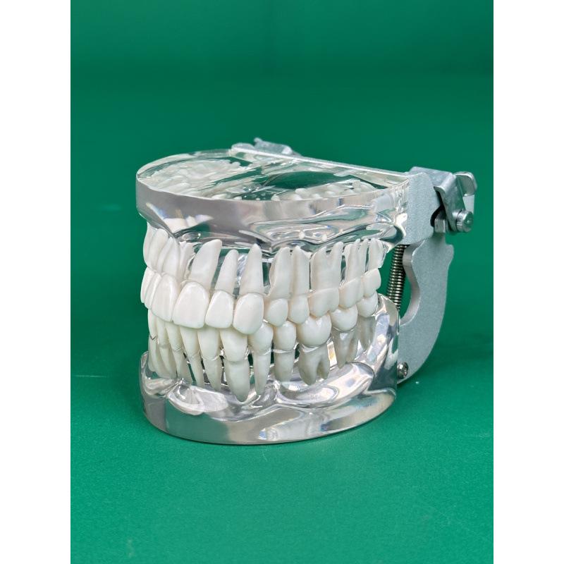 Прозора Знімна Повна Модель Щелепи з М'якими Яснами та Зубами для Підготовки до Імплантації