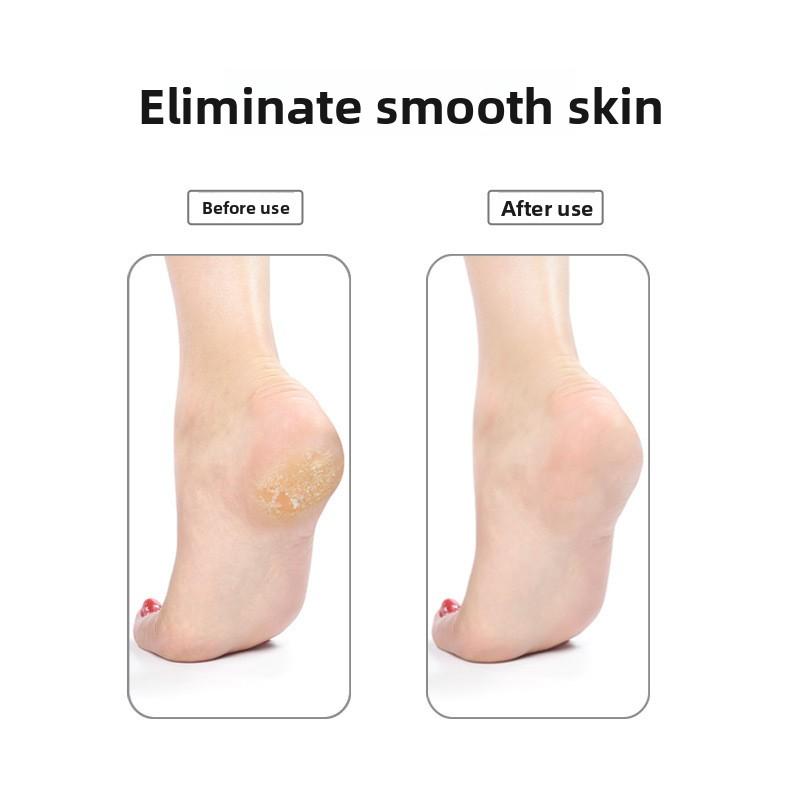 Professional Foot Exfoliation Tool PU Foam Grindstone for Callus Removal and Smooth Feet with Fine Matte Finish