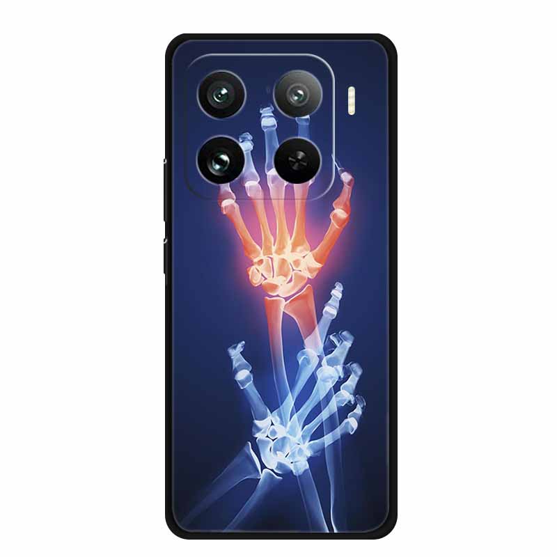 Handyhülle Für Xiaomi 15 S Pro Rückseite Hülle Stoßfest Schwarz Silikon Weich Coque Für Xiaomi 15 15s Pro Hülle 15Pro Funda Schale