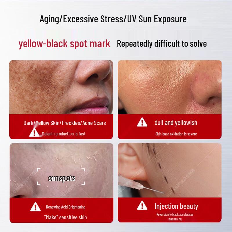 Niacinamide Whitening & Spot Fading Serum