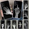 Autumu X Ray Hand Bones Phone Case Cover for Samsung Galaxy A12 A22 A32 A52 A72 A02S A51 A50S A31 A20S A10S Note 20 Ultra 10 Plu