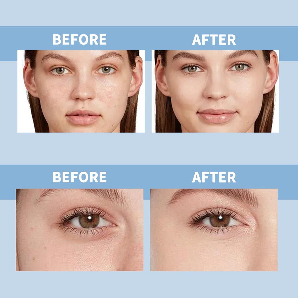 Hyaluronic Serum, Ultra Moisturizing Serum Firming And Brightening Moisturizing Facial Serum,1.2ML*5PCS