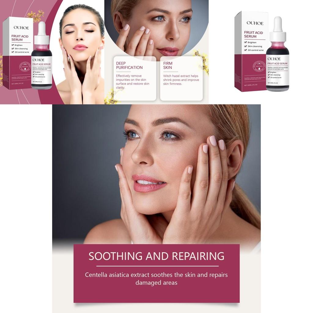 Ouhoe Gentle Exfoliating Essence With Aha For Hydration And Skin Moisturization 30ml