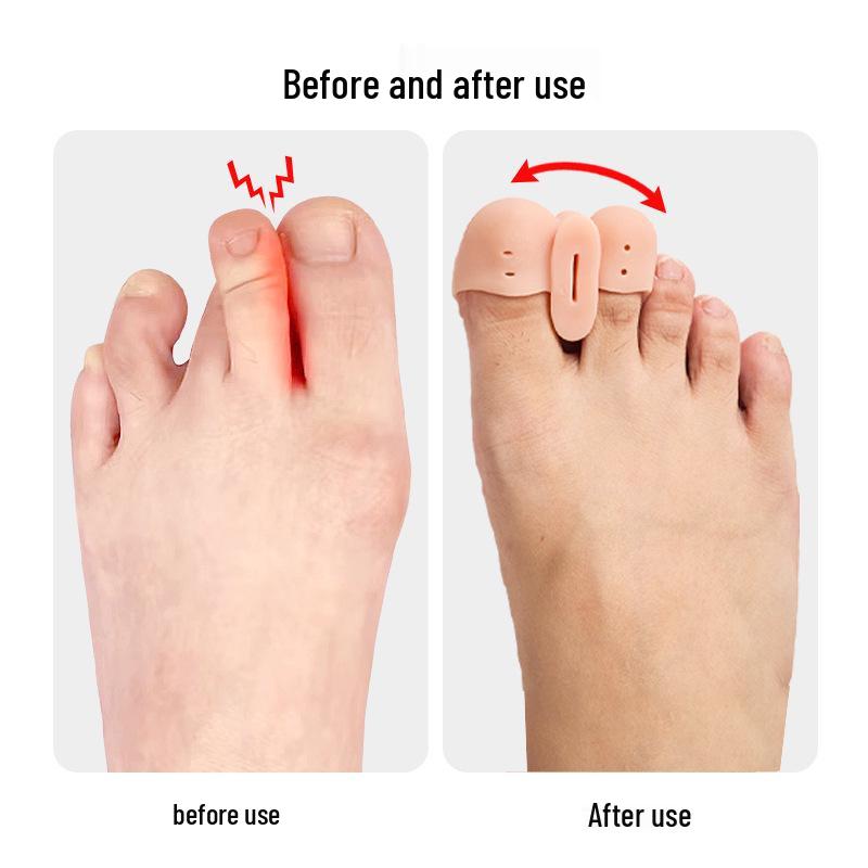 Two-Hole Silicone Orthotic Toe Separator for Big Toe Alignment