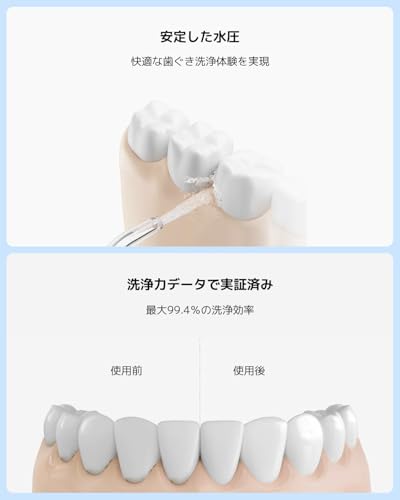 Xiaomi Water Flosser 2, High-Frequency Pulse Water Flow, Stabilized Water Pressure, 99.4% Cleaning Efficiency, 3 Adjustable Modes, 2 Nozzles, IPX7 Wat