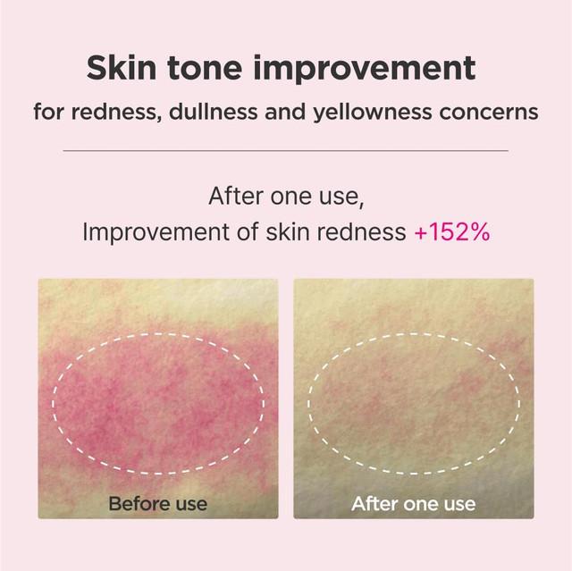 isoi Blemish Care Up Serum 35mL / 50mL / 70mL/ Reduces Pigmentation and Blemishes, Moisturizing, Korean Cosmetics, Kbeauty