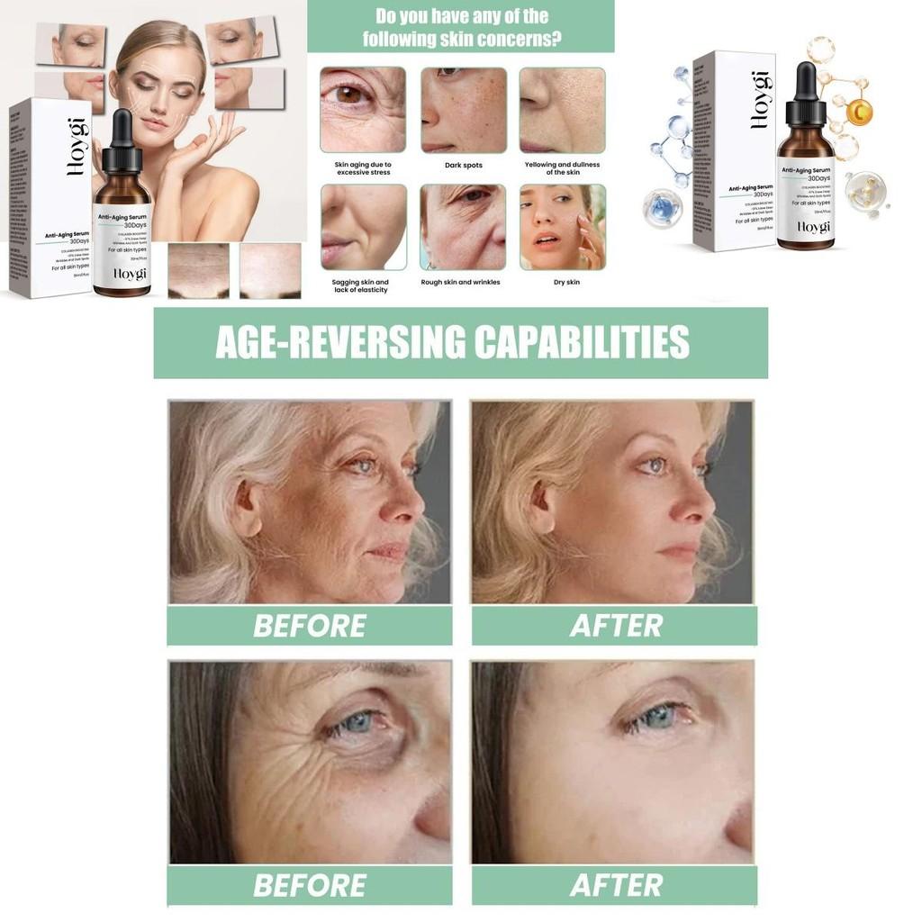 Hoygi Anti-aging Facial Serum Nourishing Hydrating Formula For Youthful Radiant Skin