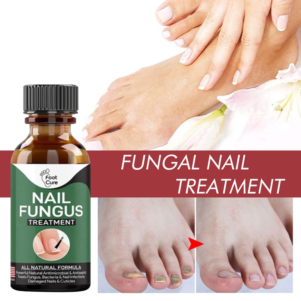 50ML Nail Treatment Solution Nail Repair Liquid Accelerate Metabolism Onychomycosis Treatment