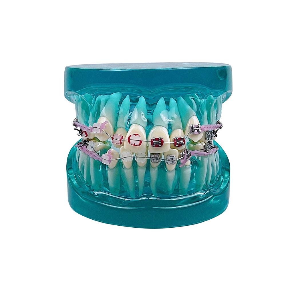 New Dental Orthodontic Treatment Model Standard Teaching Model Dental Teeth Model With Bracket Half Metal Half Ceramic 2 Colors