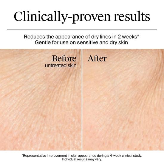 Neutrogena Hydro Boost Hyaluronic Acid Nourishing Cream| 72-Hour Deep Hydration | All Skin Types | For Men & Women 50g