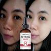 Whitening and Spot Lightening Essence Repairing Skin with Vitamin Moisturizing Facial Essence Brightening Facial Essential Oil