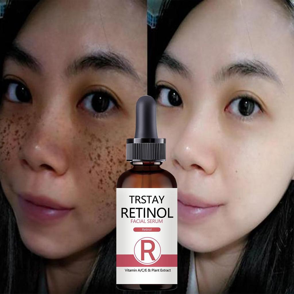 Whitening and Spot Lightening Essence Repairing Skin with Vitamin Moisturizing Facial Essence Brightening Facial Essential Oil