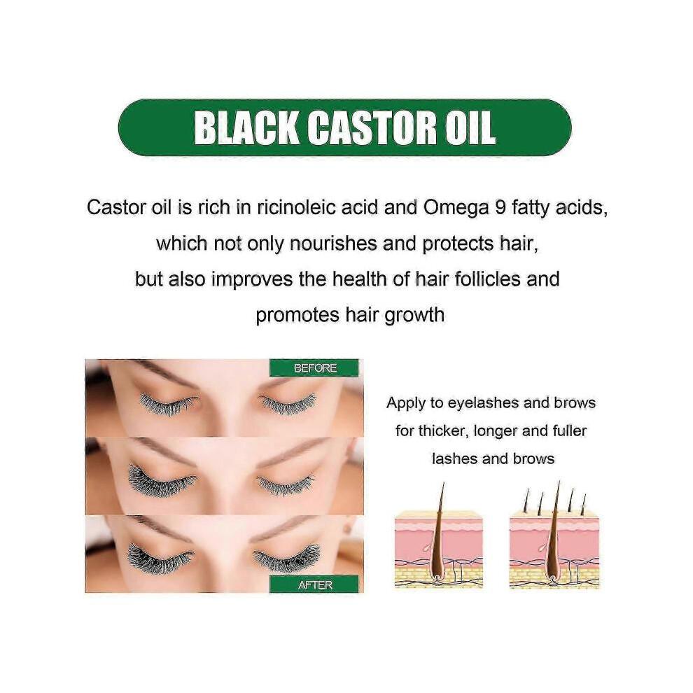 Ouhoe Castor Oil Hair Serum Improves Hairline, Strengthens Hair, Nourishes Hair Roots, Softens Hair And Prevents Hair Loss -jxlgv | |