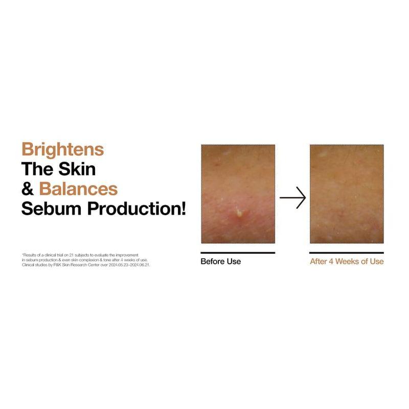 Anua Reis 70 Glow Milchiger Toner