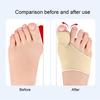 3 Pairs Toe Correction Device Breathable Fabric Ergonomic Toe Corrector Adaptive Fit Bunion Correction Sleeve