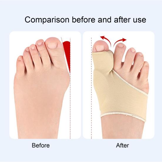3 Pairs Toe Correction Device Breathable Fabric Ergonomic Toe Corrector Adaptive Fit Bunion Correction Sleeve