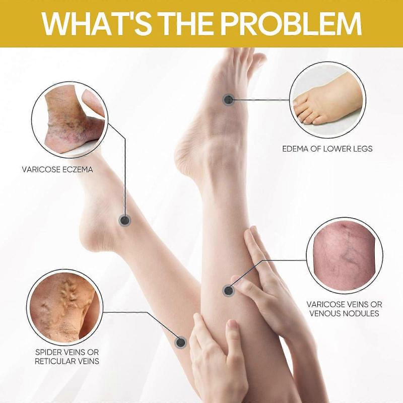 Bee Venom Anti-Varicose Soothing Cream with Vitamin K, Reduces Swelling & Spider Veins, Leg Care Cream, 100ml