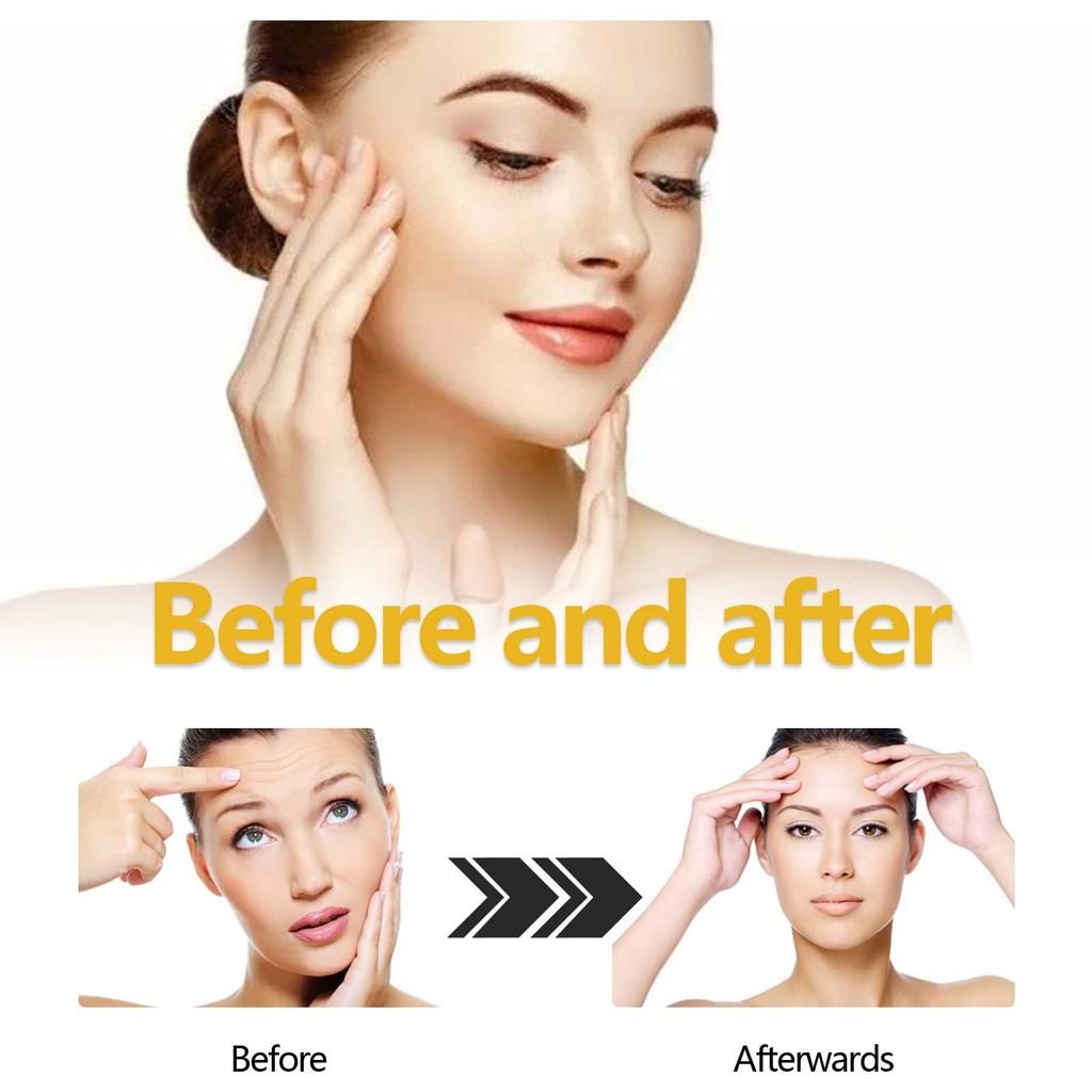 Ouhoe Revitalizing Serum For Diminishing Fine Lines And Brightening Skin Hydrating Moisturizing Formula 30ml