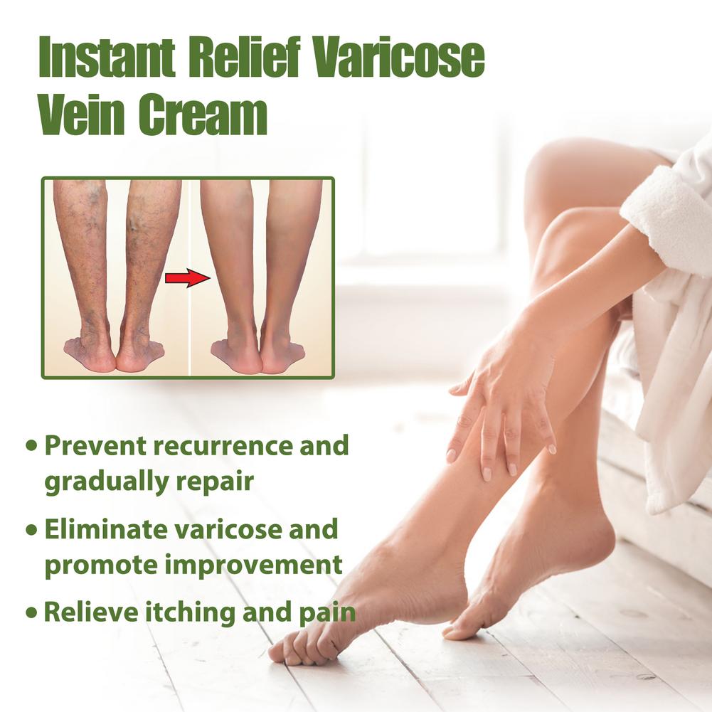 50g Varicose Vein Repair Cream Tongmai Effective Relieves Leg Bulge Pain Treatment Cream Vasculitis Phlebitis Vein Repair Cream