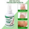 English Foot Peeling Spray: Anti-Heel Dryness & Crack Relief, Exfoliating Foot Mask for Removing Dead Skin.
