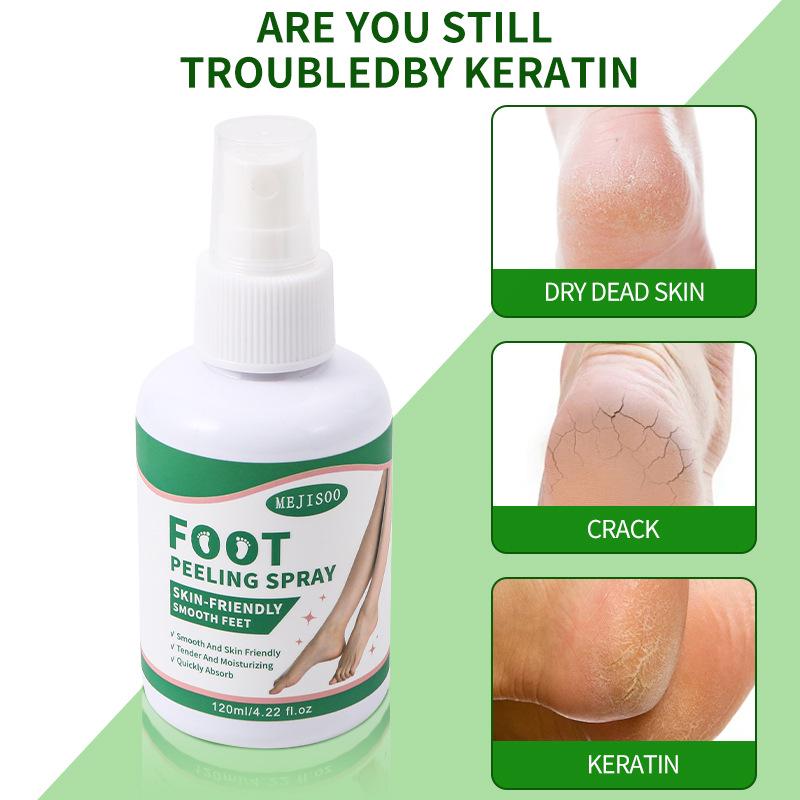 English Foot Peeling Spray: Anti-Heel Dryness & Crack Relief, Exfoliating Foot Mask for Removing Dead Skin.