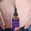 TRSTAY Stretch Mark Cream odstraňuje jizvy bělící krém pleťové krémy péče o pleť