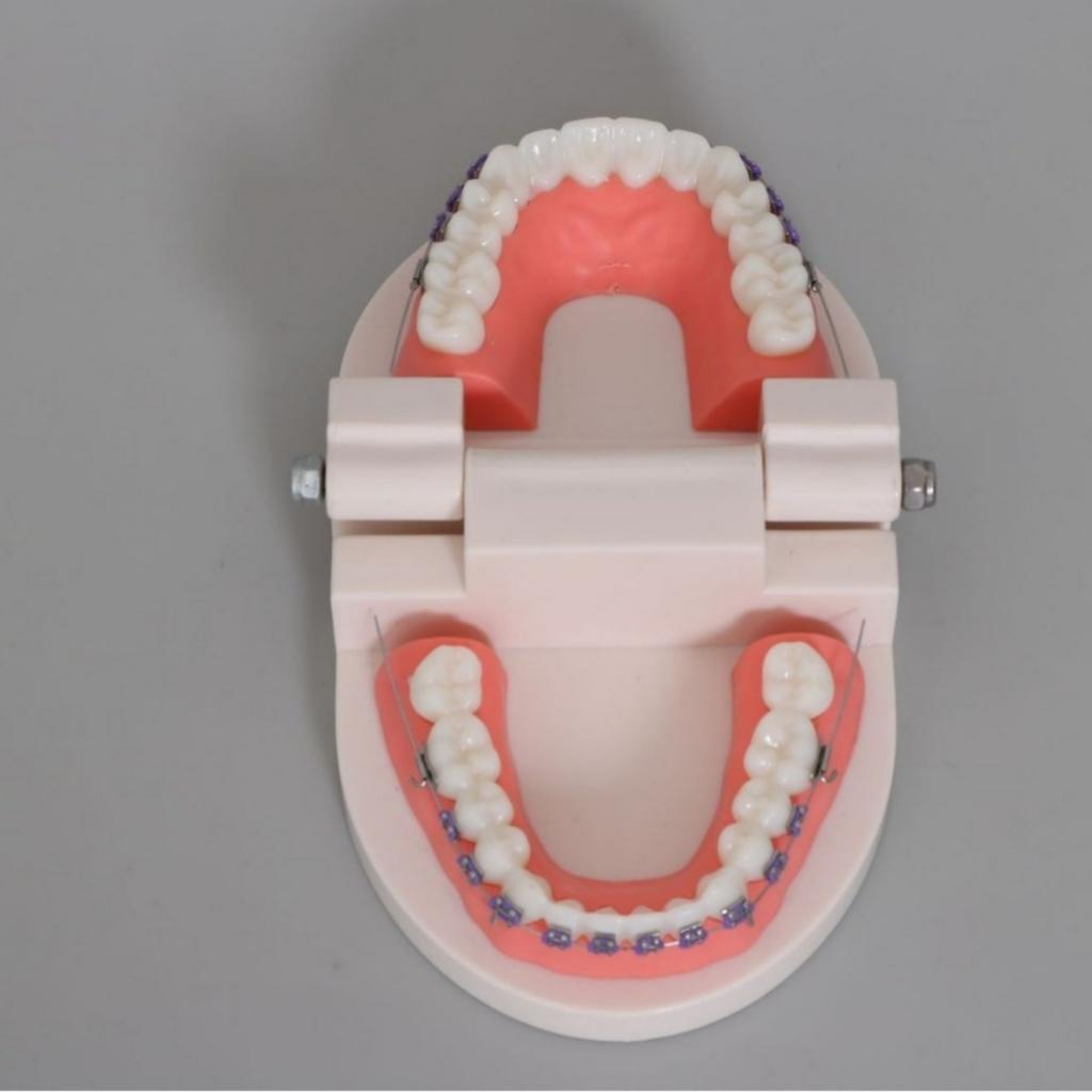 1 Stück Zahnärztliche Kieferorthopädische Behandlung Zähne Modell Mit Bracket Bogendraht Bukkalröhrchen Ligaturdrähte Zahnarzt Labor Zahnmodell Lehrmittel