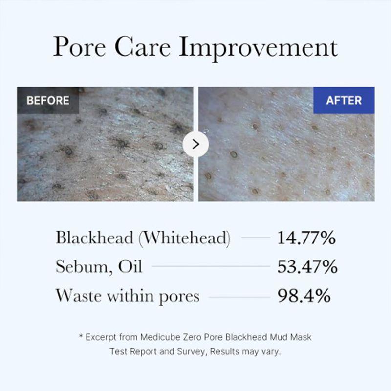 [MEDICUBE] Zero Pore Blackhead Mud Mask 100g