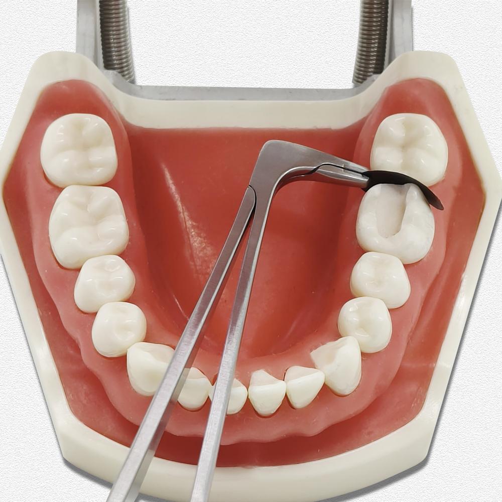 20/50 Pcs Dental Sectional Contoured Matrices Black Coated  Matrix Bands Tofflemire S/M/L Stuck  Dental Lab Material