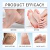 Wiyun Urea Moisturizing Foot Repair Cream Nourishing Foot Moisturizer with Urea Gentle Care for Soft Feet 100g