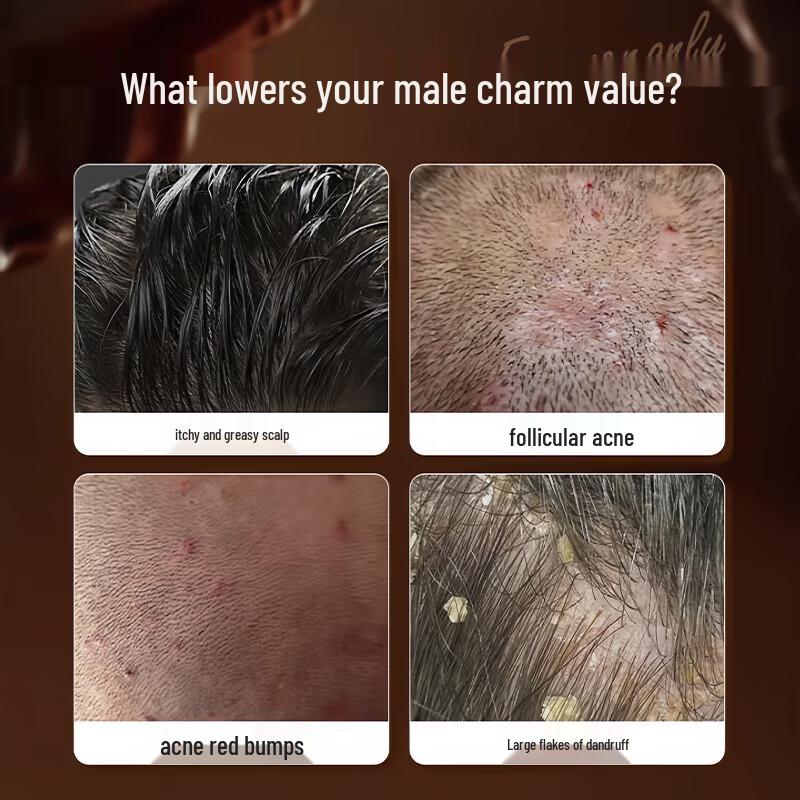 UNMS Men's Anti-Dandruff Oil Control Shampoo