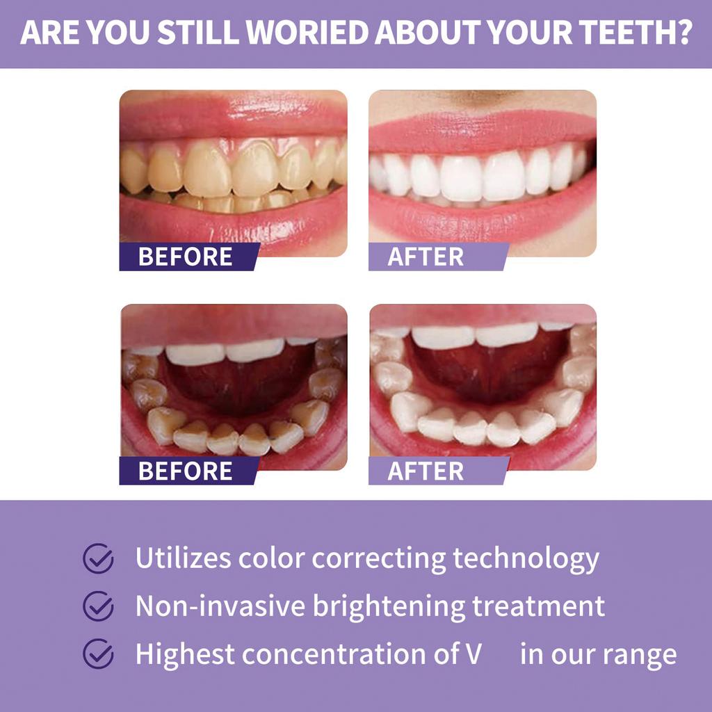 Dentifrice correcteur de couleur V34 30 ml Souris dentaire Élimine la plaque dentaire Tartre Rafraîchit l'haleine Hygiène bucco-dentaire Dents jaunes