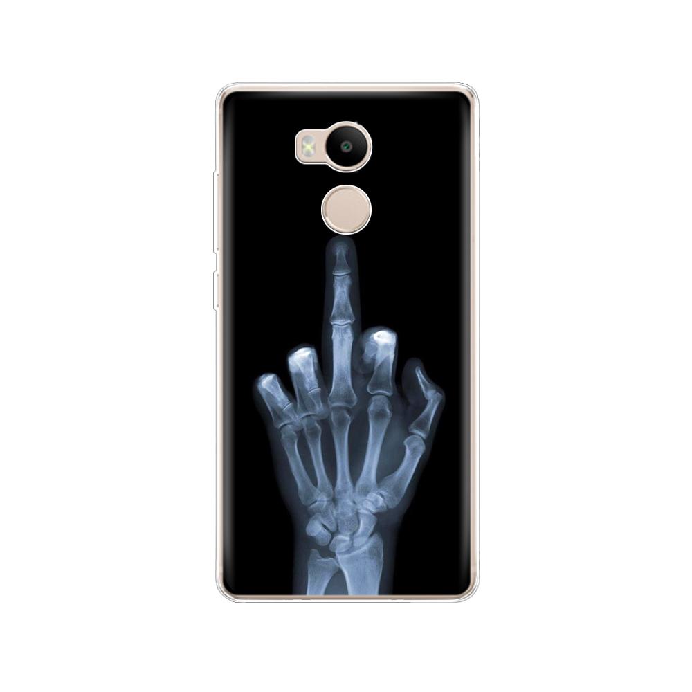 soft TPU Cases For xiaomi Redmi 4 pro Case Cover Silicon phone Cover For Redmi 4 prime Case printing 360 full protective coque