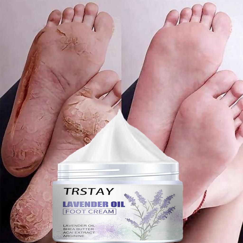 Gentle and Non-irritating, the Chapped Foot Repair Cream Hydrates and Nourishes the Skin, Leaving It Soft and Delicate