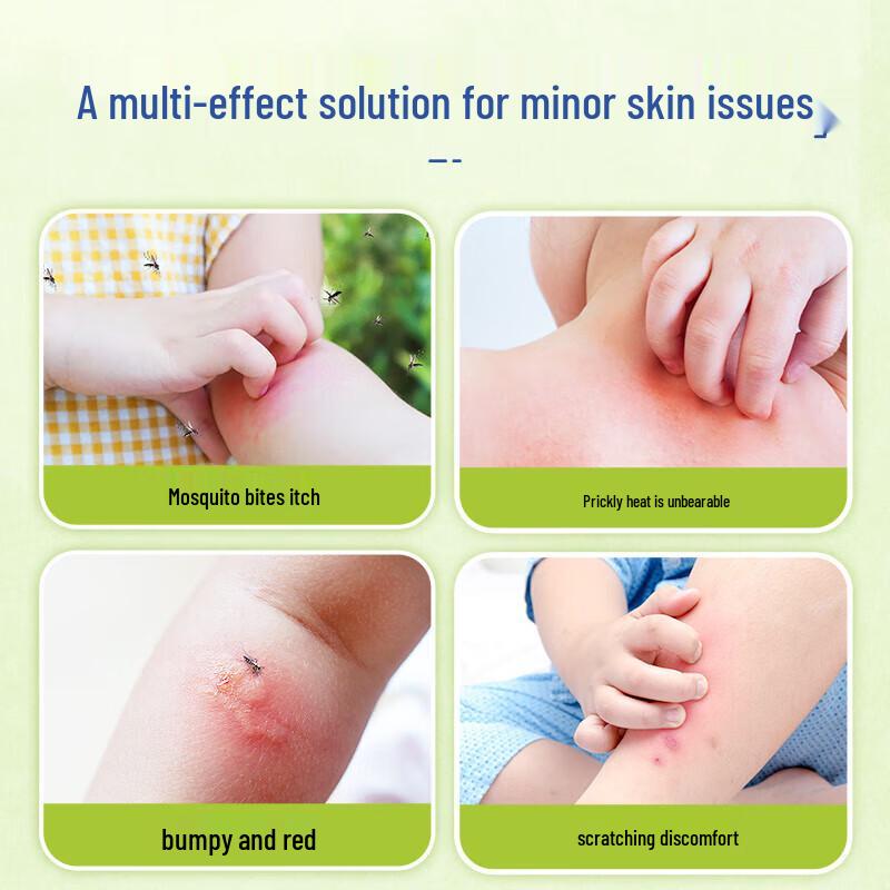 BOIRON Calendula Anti-Itch Balm 30g