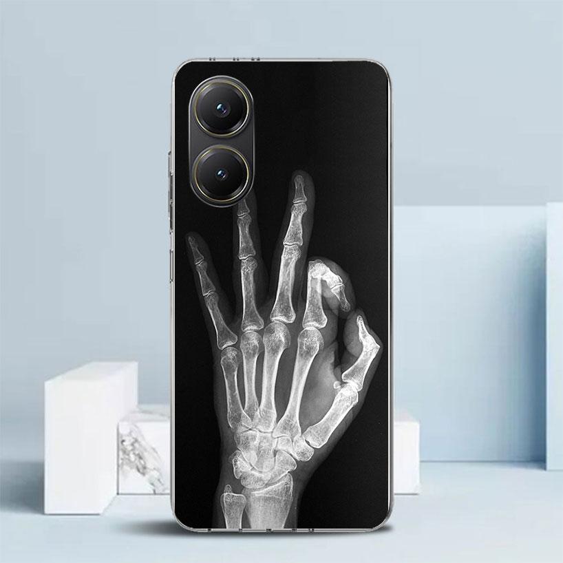 

Autumu X Ray Hand Bones Soft Cover for Xiaomi Poco F7 Ultra X7 X6 X5 Pro M7 Phone Case Redmi 15 15C 13 13C 12 12C 10 10C Print S Xiaomi Poco X6