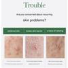 [Anua] Heartleaf Centella Red Spot Cream 30g