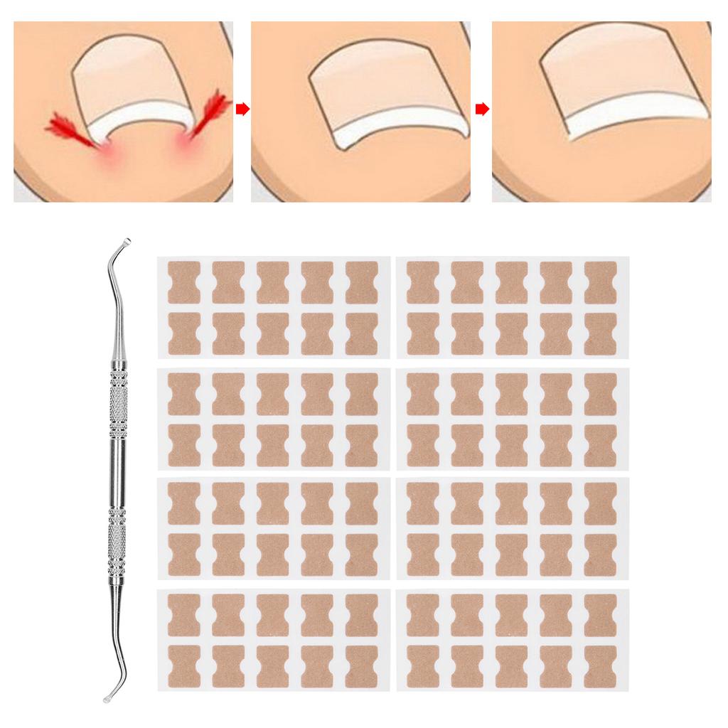 9pcs Set Ingrown Toenail Correction Stickers Ingrown Toenail Patch Planing Tool