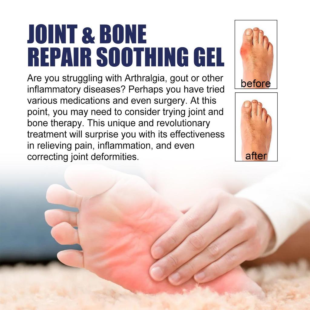 EELHOE Joint Care Gel Relieves wrist and knee discomfort Gentle ingredients for external use Body massage care