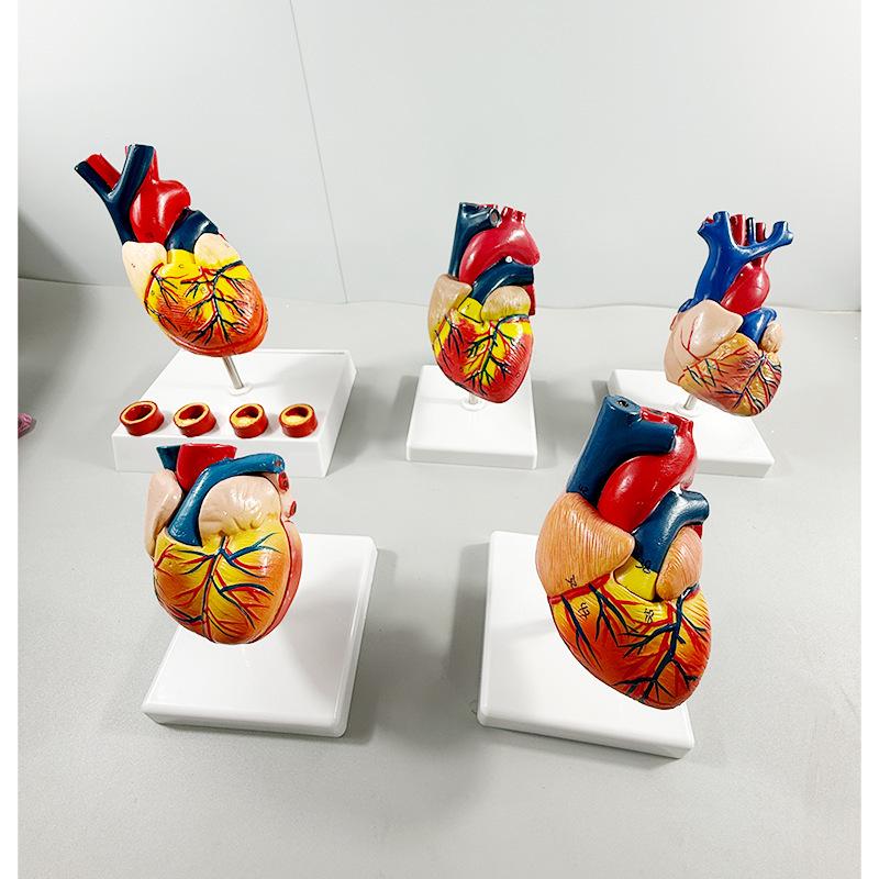Removable Human Heart Anatomy Model with B-mode Color Doppler