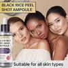 Black Rice Peel Shot Ampoule-Deeply Hydrates And Soothes Dry Or Irritated Skin-Suitable For All Skin Types,100ml