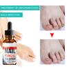 10ml/20ml/30ml Anti Fungus Liquid Toe Finger Nail Infection Repair Treatment